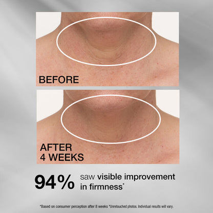 StriVectin