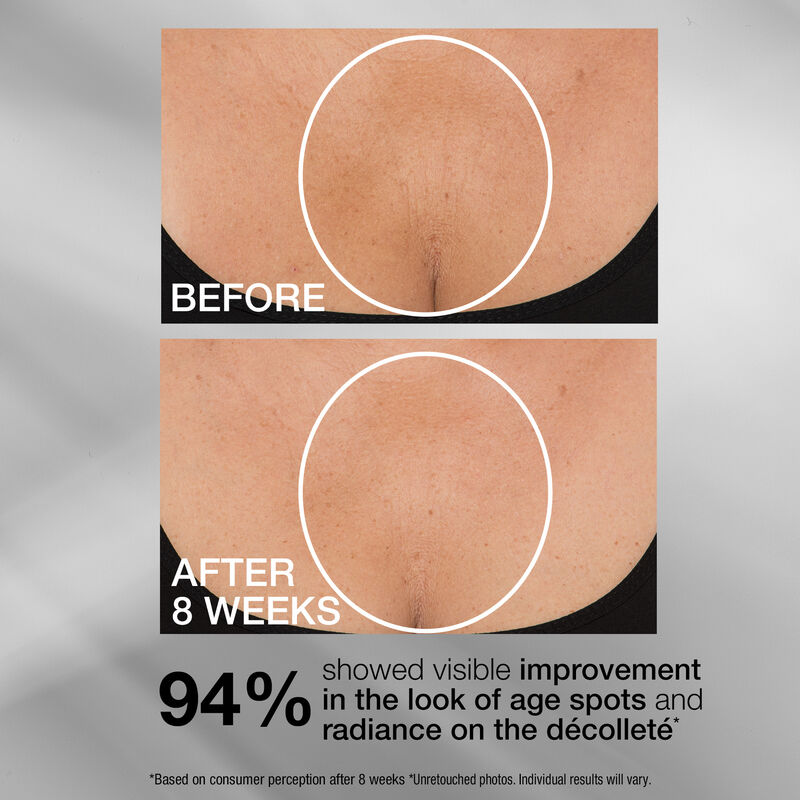 StriVectin