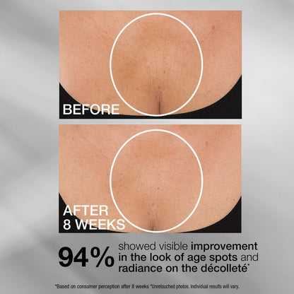 StriVectin